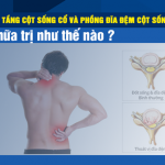 Thoát vị đĩa đệm đa tầng cột sống cổ và phồng đĩa đệm cột sống lưng, chữa trị thế nào?