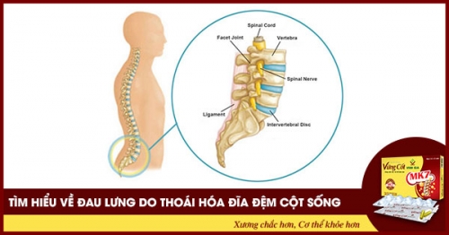 Tìm hiểu về đau lưng do thoái hóa đĩa đệm cột sống